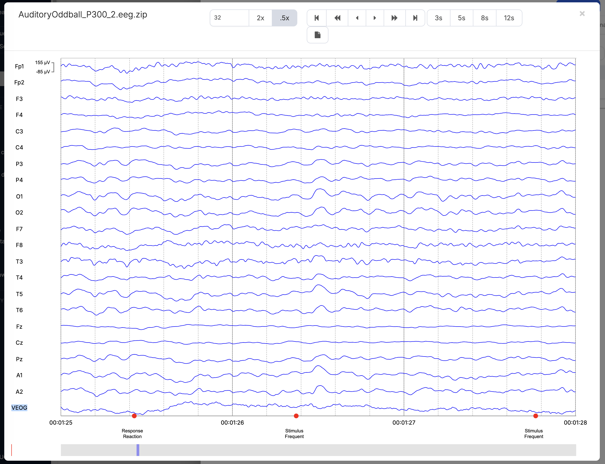 EEG Viewer UI