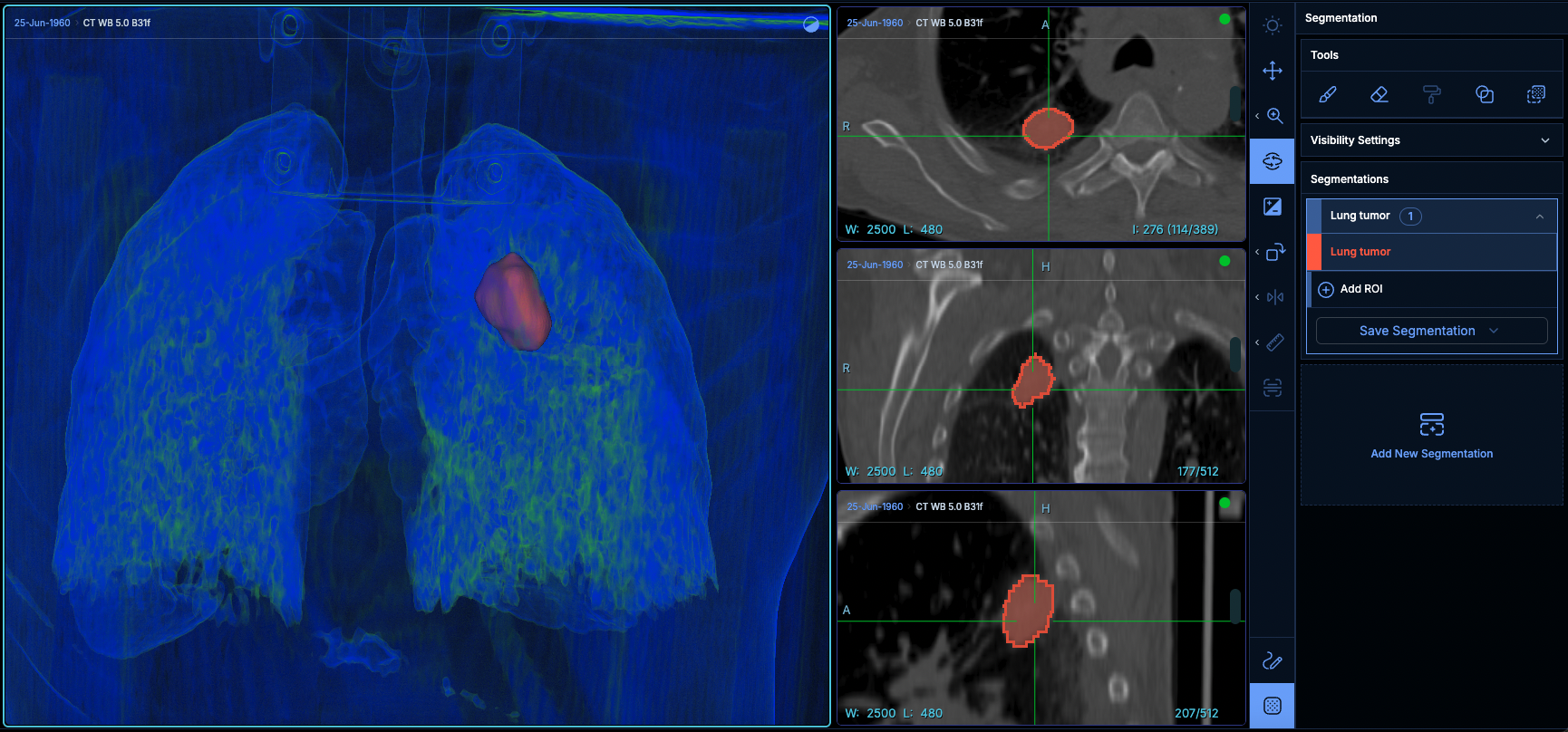 3D ROI view