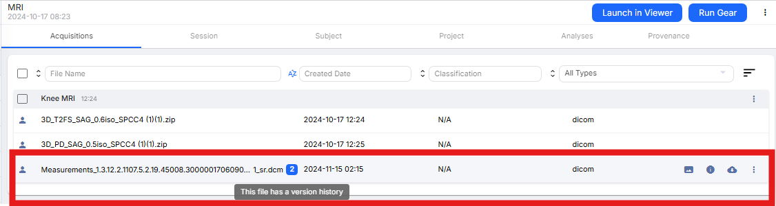 DICOM SR versions in Flywheel UI