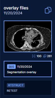 Seg files