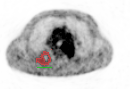 rectangle_roi_segmentation