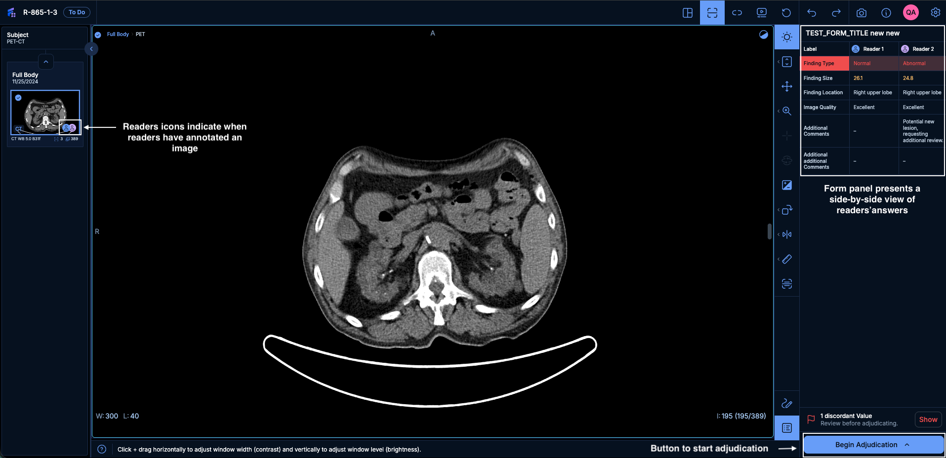 Adjudication task interface in the V3 Viewer